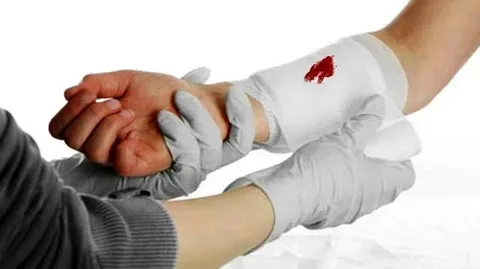 تصویر 3 از قیمت خرید باند پانسمان کشی + فروش ویژه